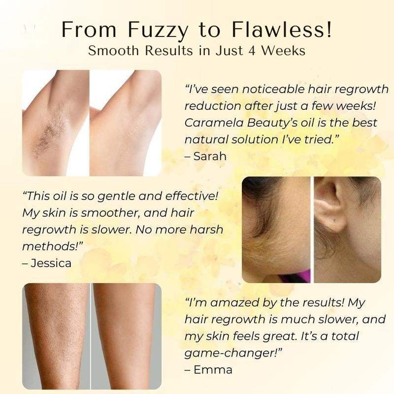 Cyperus Rotundus Oil for Hair Reduction