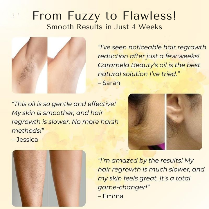 Cyperus Rotundus Oil for Hair Reduction